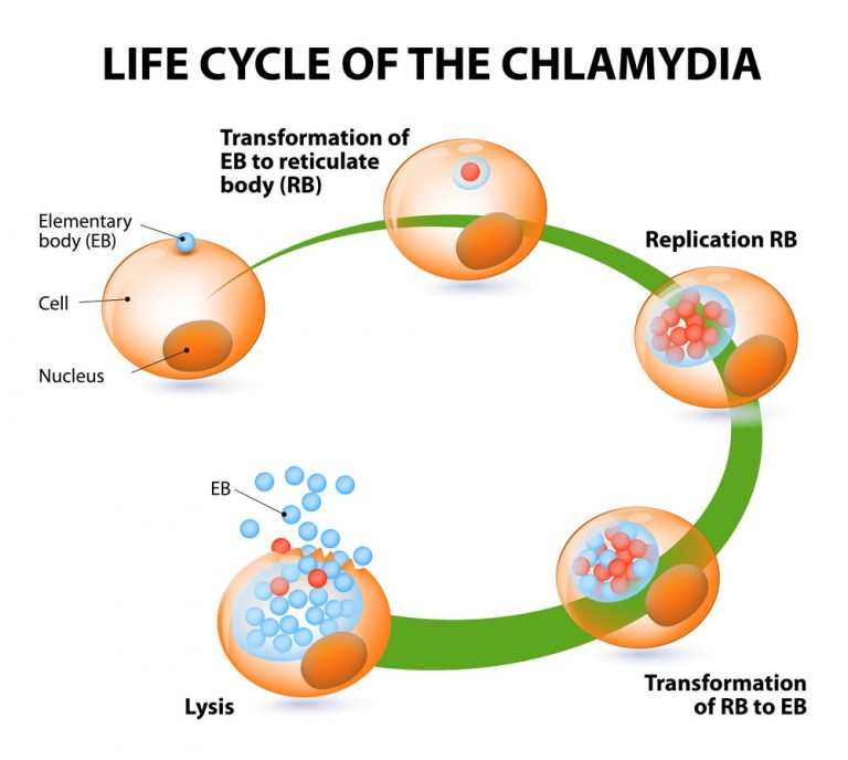 Chlamydia Pneumoniae Symptoms Types Diagnosis Treatment 6098