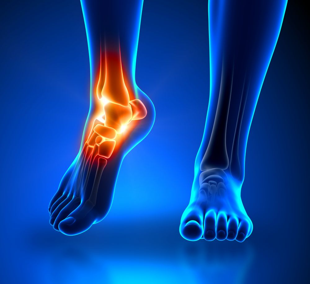 Ankle Pain Symptoms Causes And Treatment Stdgov Blog