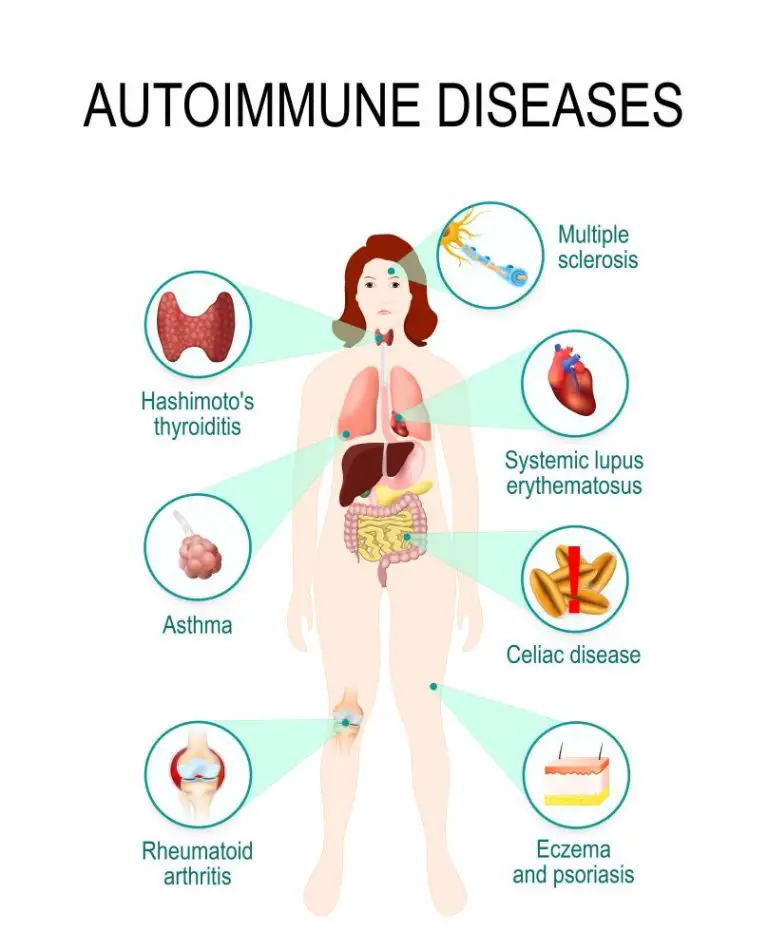 Immune System Diseases Types Symptoms Prevention STD GOV Blog