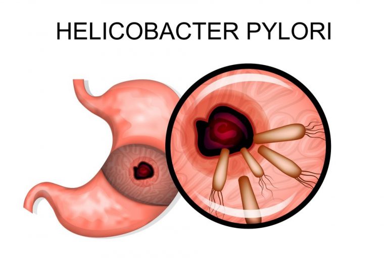 Helicobacter Pylori Transmission, Test, Diet STD.GOV Blog