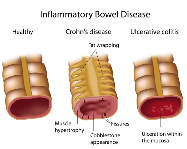 stomach-cramps-causes-treatment-pregnancy-std-gov-blog