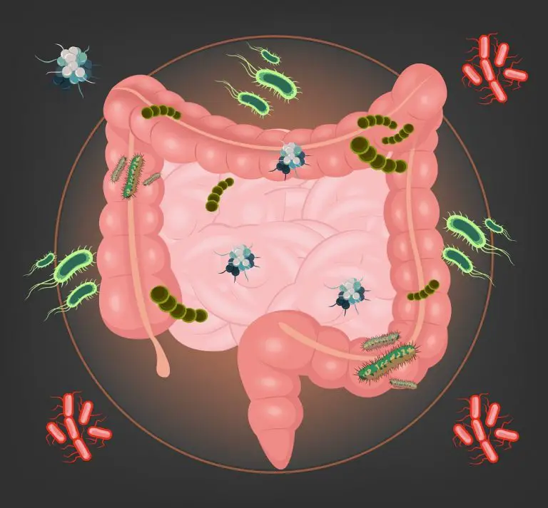 What Does A Bowel Infection Mean