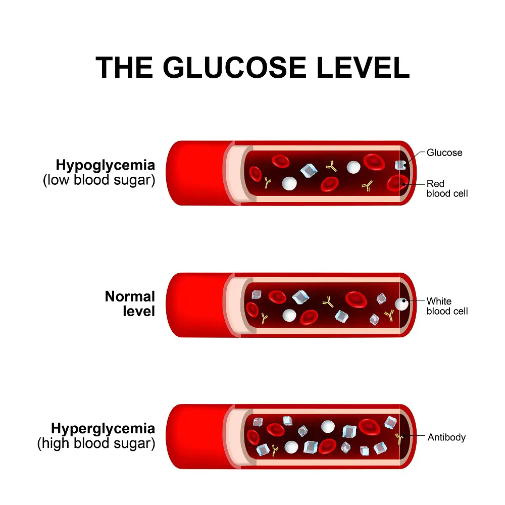 Hyperglycemia In Pregnancy STD GOV Blog