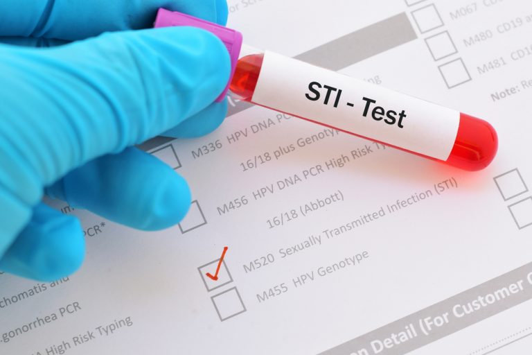 how-doctors-test-for-stds-std-gov-blog