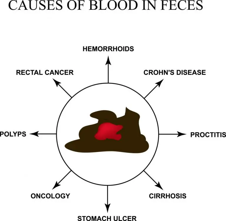 causes-of-blood-in-stool-std-gov-blog