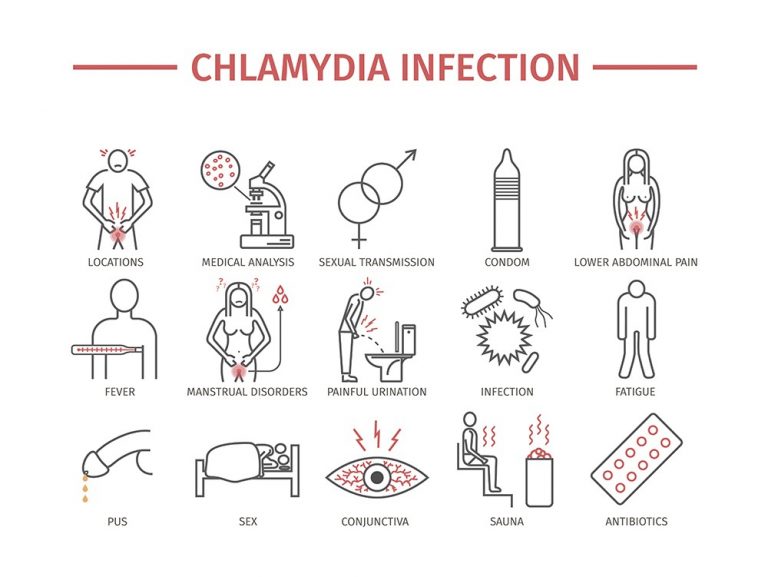 Chlamydia In Men Symptoms Diagnosis Treatments