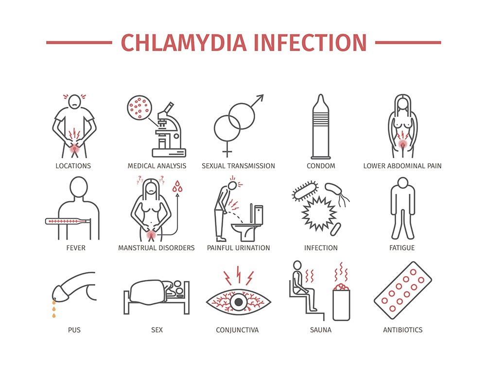 Chlamydia in Men symptoms, diagnosis, treatments