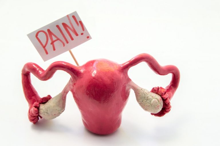 ovary-pain-major-causes-anatomy-treatment-options