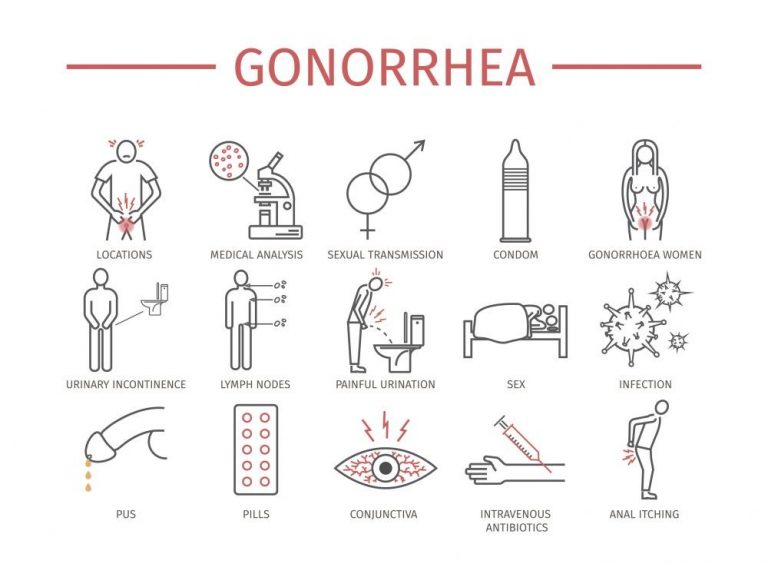 Super Gonorrhea history, diagnosis, last news, pictures