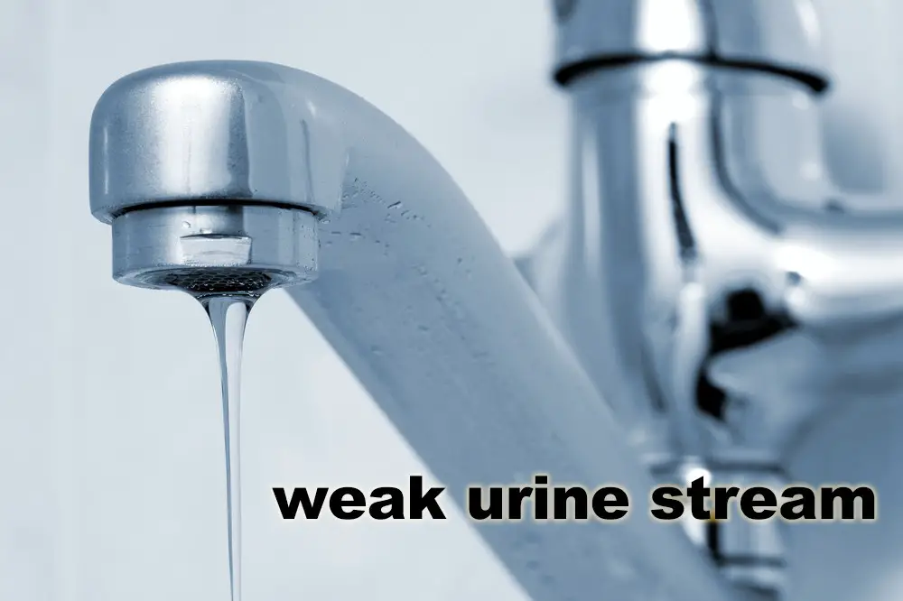 Weak Urine Stream Reasons Treatment Male Female