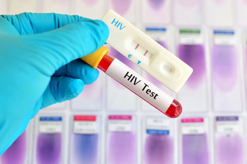 STI STD Testing Procedure Information For Men And Women