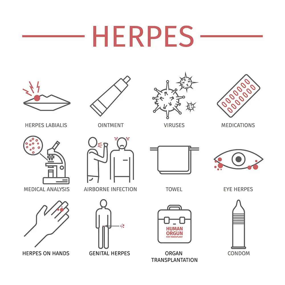 How Do You Get A Herpes Virus At Joanna Kennard Blog