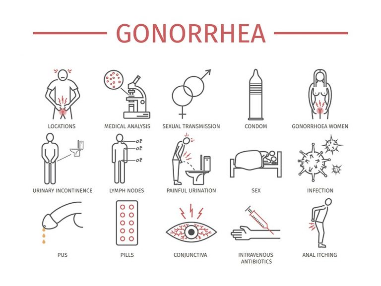 discharge gonorrhea symptoms pictures