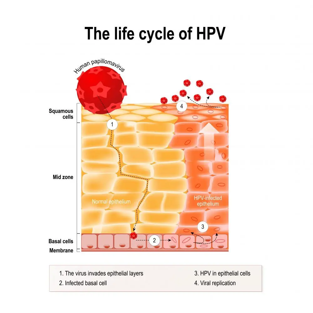 HPV Symptoms Treatment Vaccine HPV In Men And Women